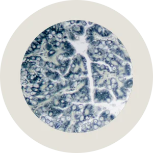 أدوية علاج الكوكسيديا